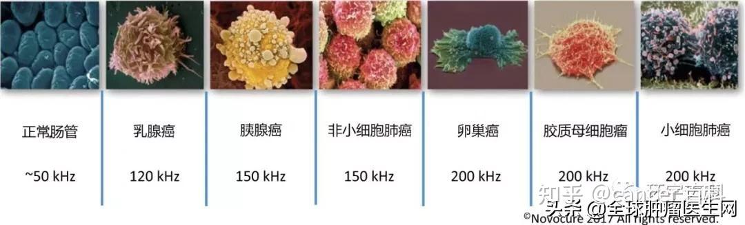 种理想的方式能针对性的阻止癌细胞的分裂,同时要对正常细胞没有影响