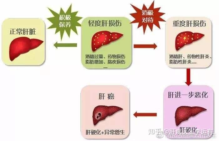 急性肝炎与慢性肝炎的区别慢性肝炎更容易变成肝硬化