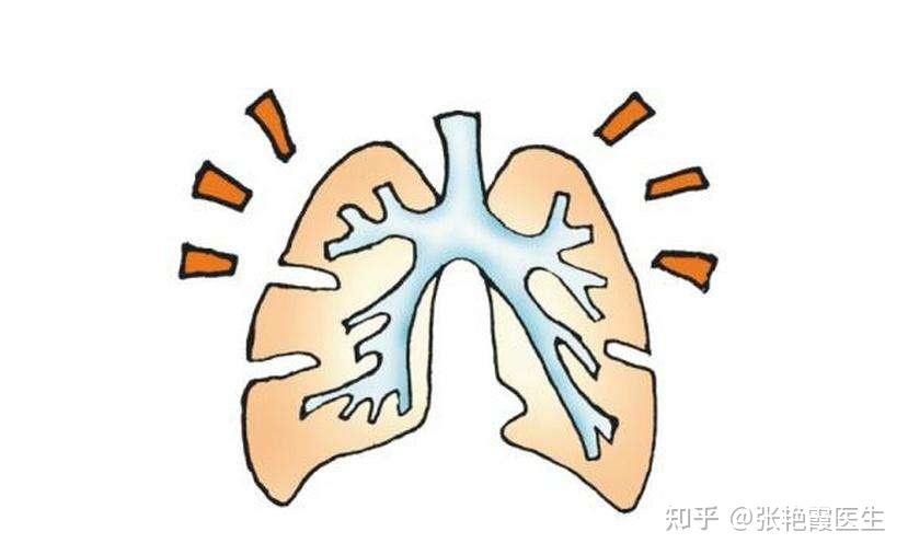 67岁男子慢性支气管炎25年天冷发作如何缓解