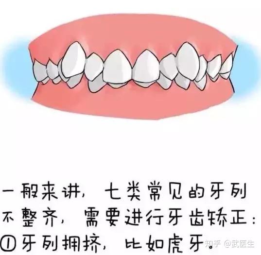 时间越短,其实牙齿矫正是没有明显年龄限制的,它的适应证其实是牙体和
