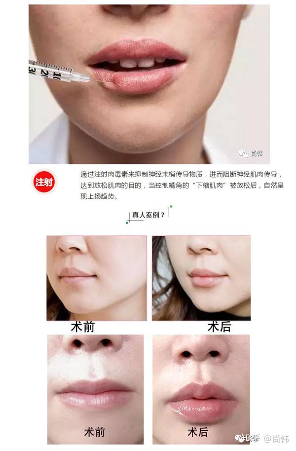 微笑唇让你微笑起来