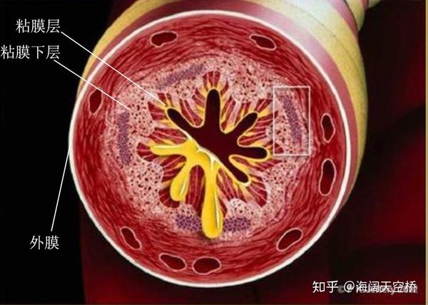 第二次更新咯——急性气管-支气管炎