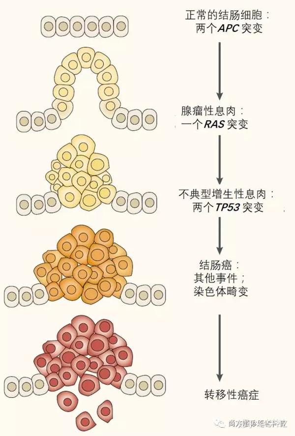 图1:正常,健康的细胞群体可以随着时间的推移而转变成具有侵袭性,癌性