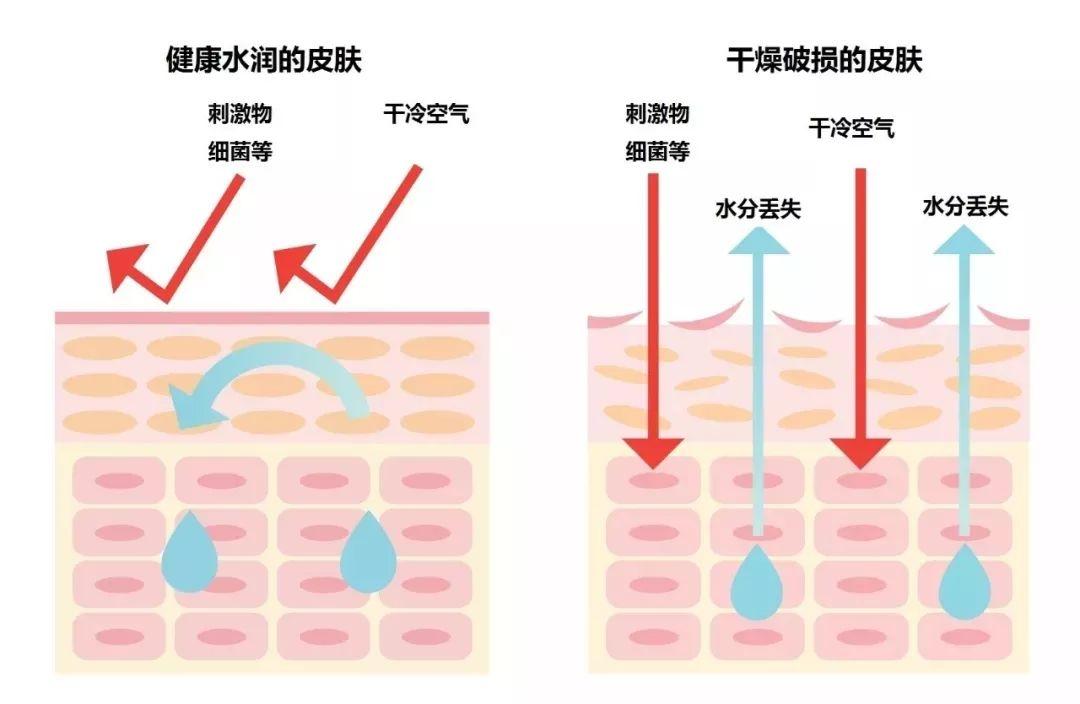 为什么秋季皮肤容易干燥?