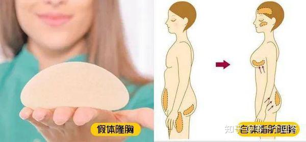隆胸妈妈的奶,宝宝能喝吗?