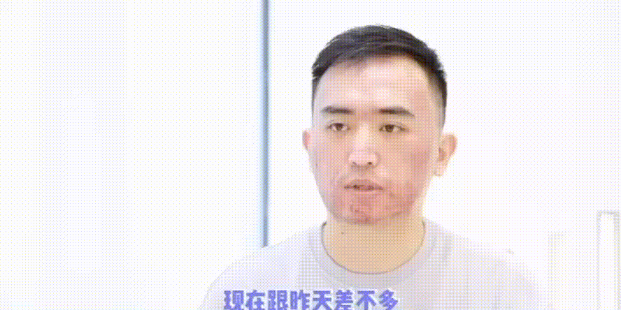 做后会起一些白色的小粉刺,不过没关系,3~4天就下去了.