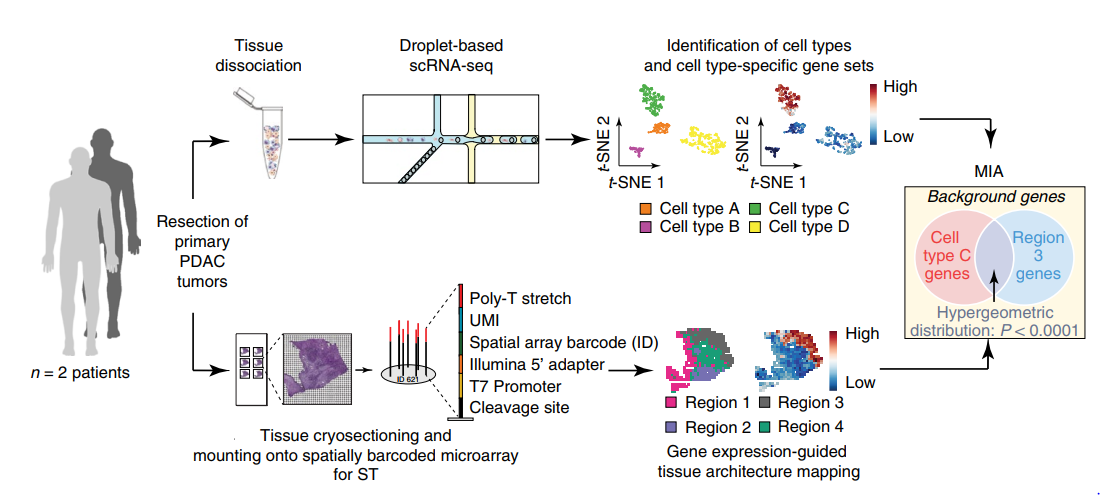 前沿直达空间转录组联合单细胞测序揭示胰腺导管腺癌结构