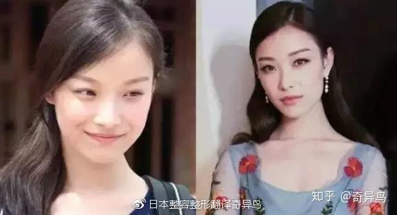 没有好看的鼻子怎么做高颜值小仙女日本整容整形