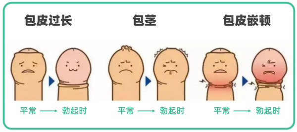 包茎则是不光穿了高领毛衣,还是个 领口又窄又紧的高领毛衣,使劲儿抻