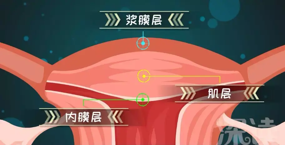 子宫肌瘤是怎么形成的