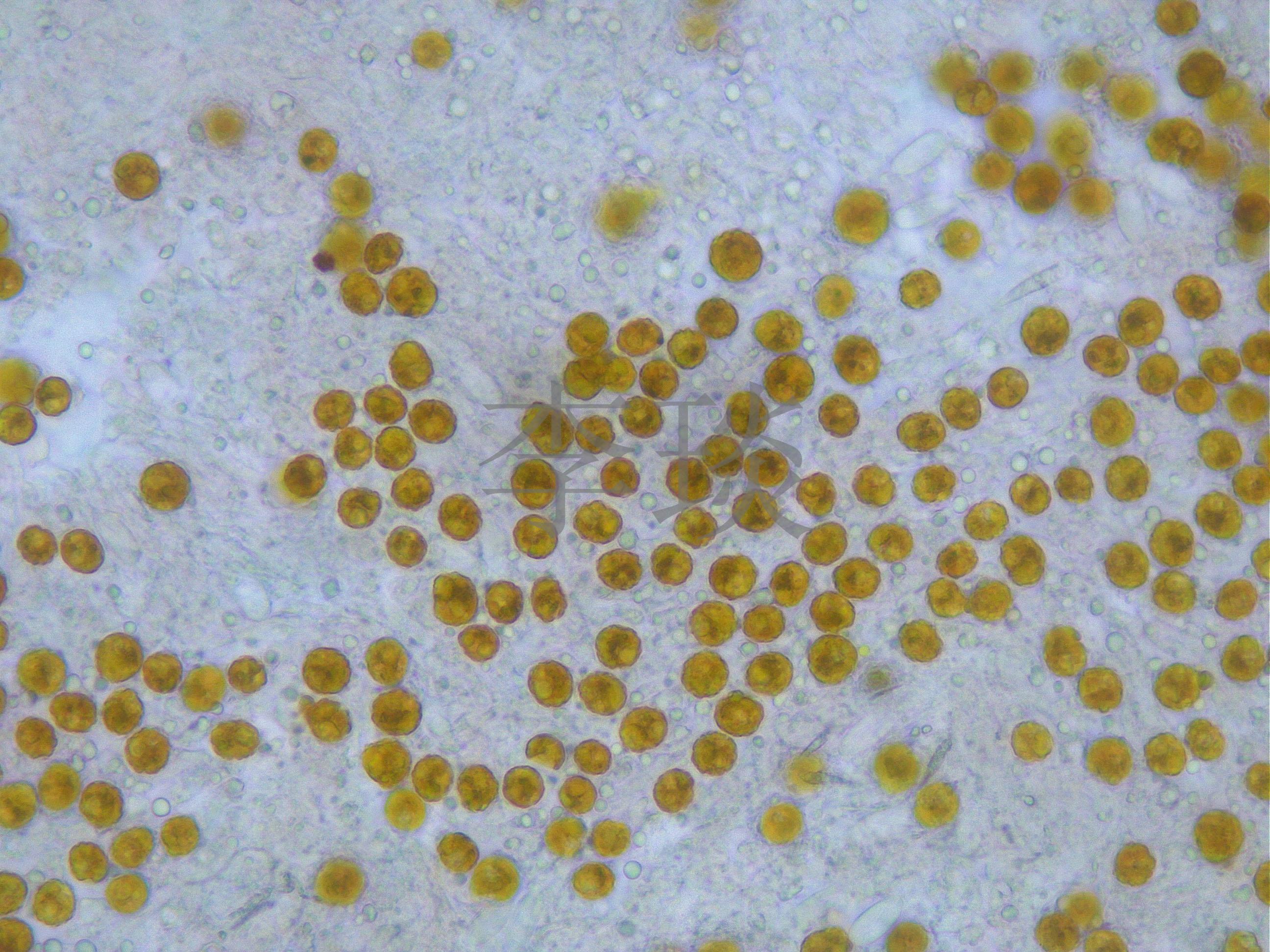 珊瑚提供给虫黄藻保护,营养盐,虫黄藻提供给珊瑚光合作用产生的糖等