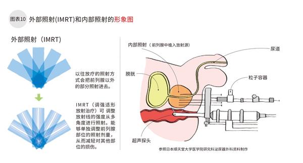 治疗前列腺癌有哪些药物疗法?