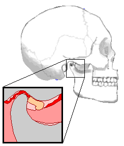 颞下颌关节的问题常常与颈椎功能障碍有关.