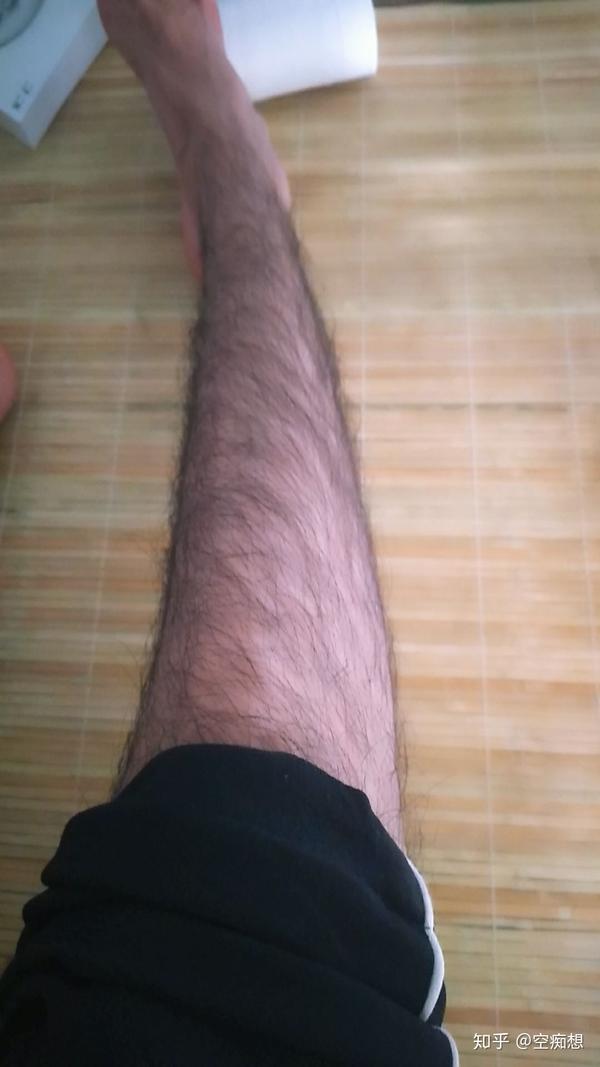 男生腿毛浓密怎么办?