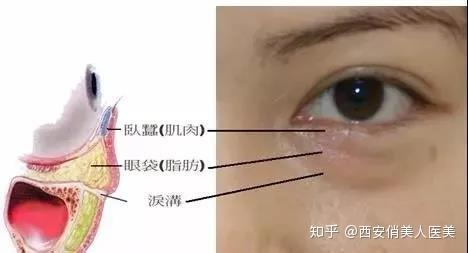 由我们眼睛周围分布的肌肉群——眼轮匝肌所形成