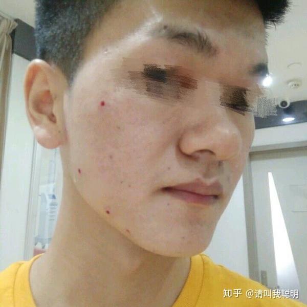 男点痣 - 知乎