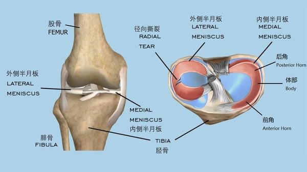 手术篇前交叉韧带重建半月板修复手术手术过程以及术后须知你所需知道