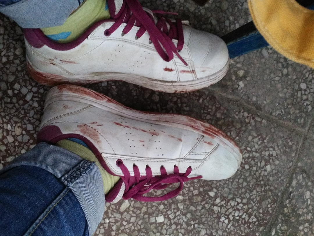 鞋子沾上红油漆如何去掉