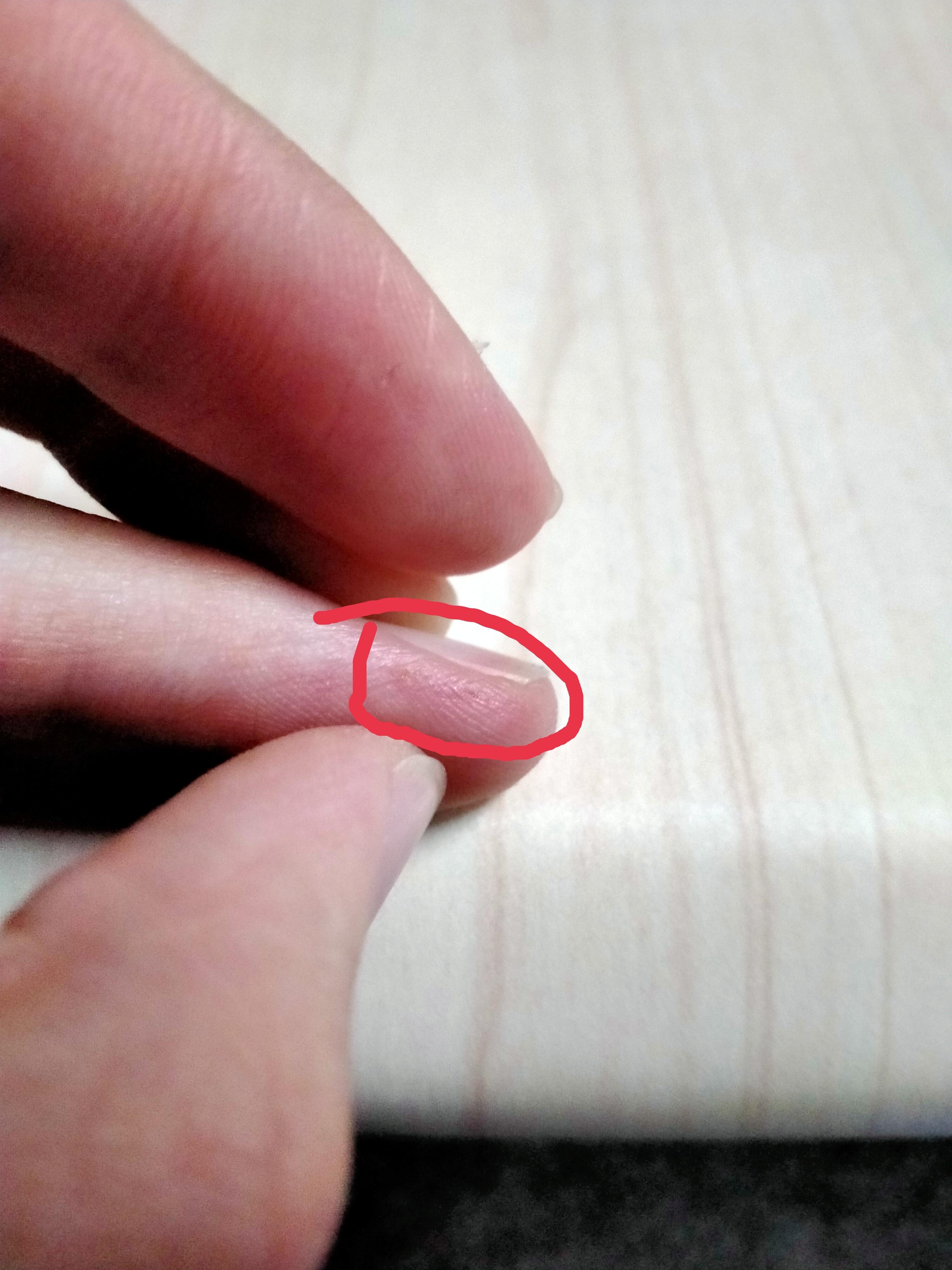 倾樱 的想法: 破伤风?