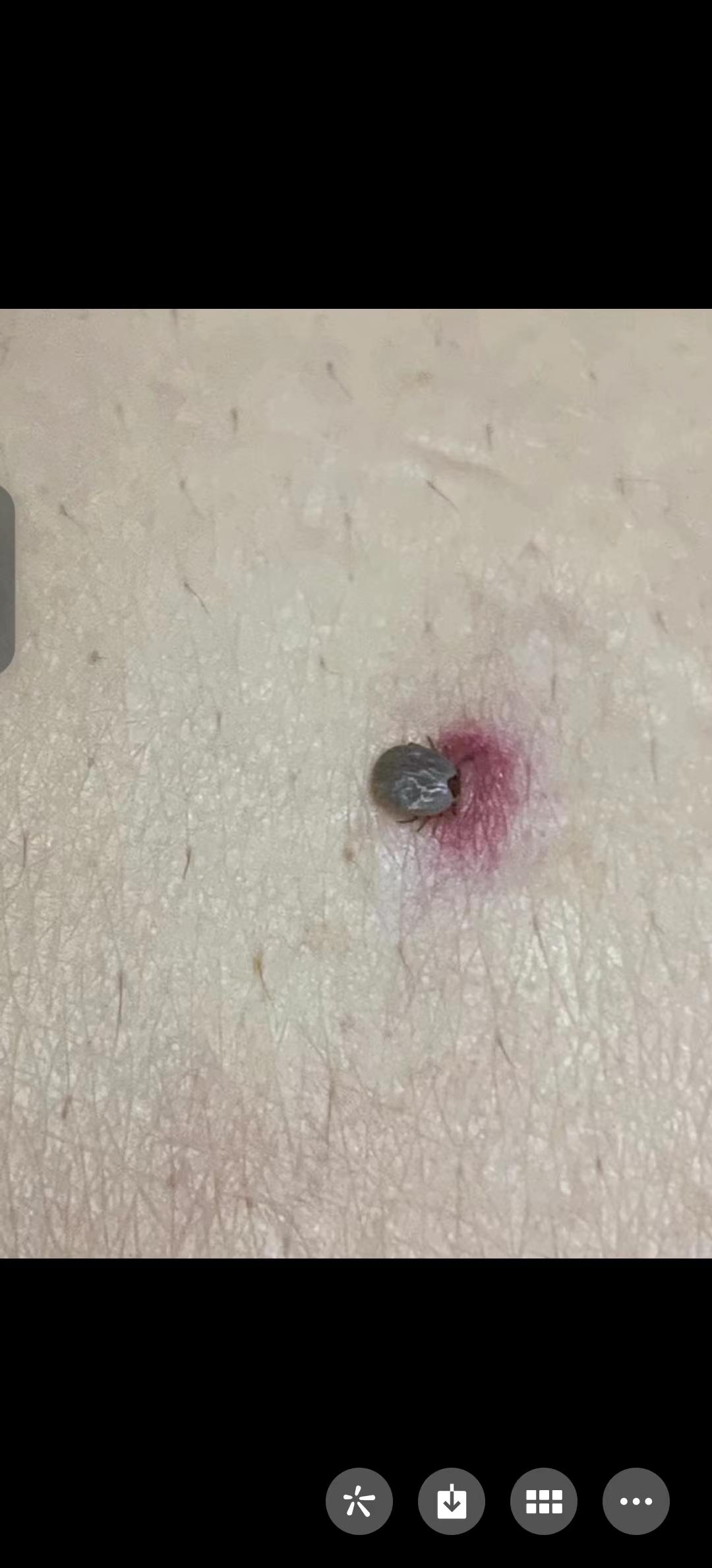 踏春挺美,蜱虫不美!