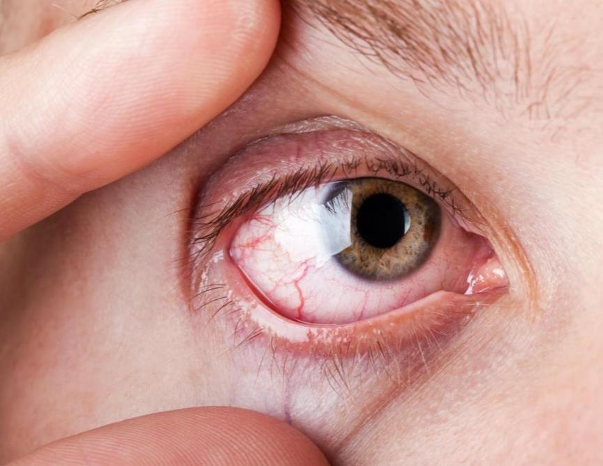 微医诊 的想法: 第一,血虚眼睛干 br>原因:肝在窍为目,所以肝血不足