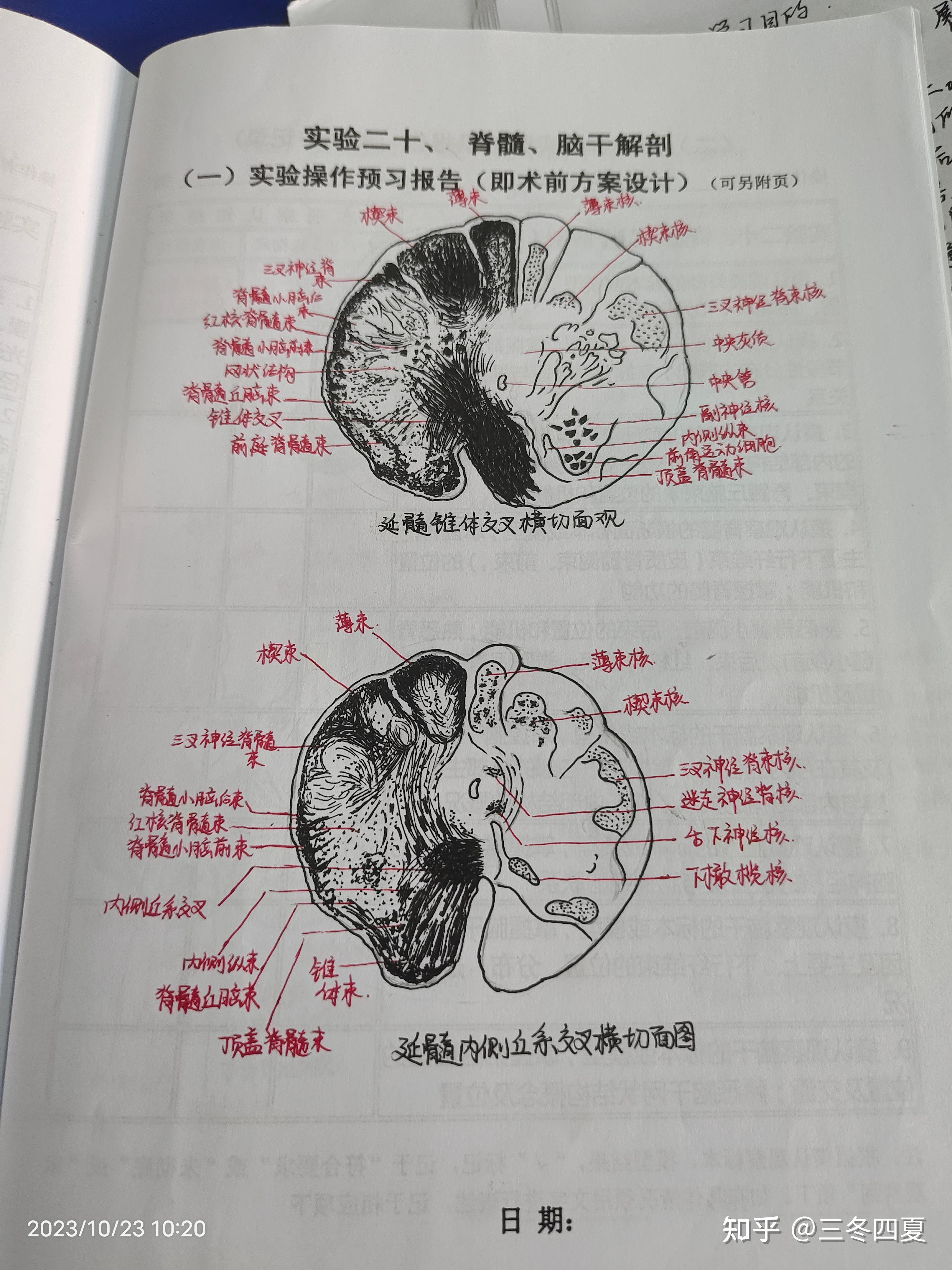 延髓锥体图片