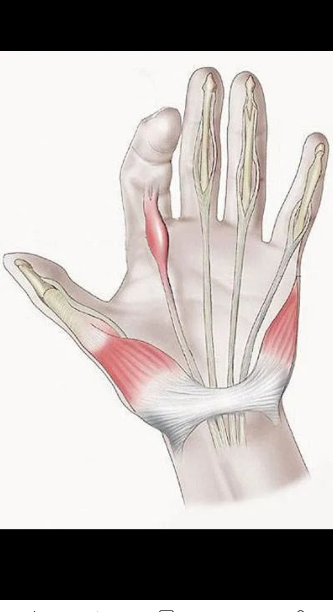 食指腱鞘炎几年前有一次扶墙不小心压了一下后来就肿了有时候隐隐作痛