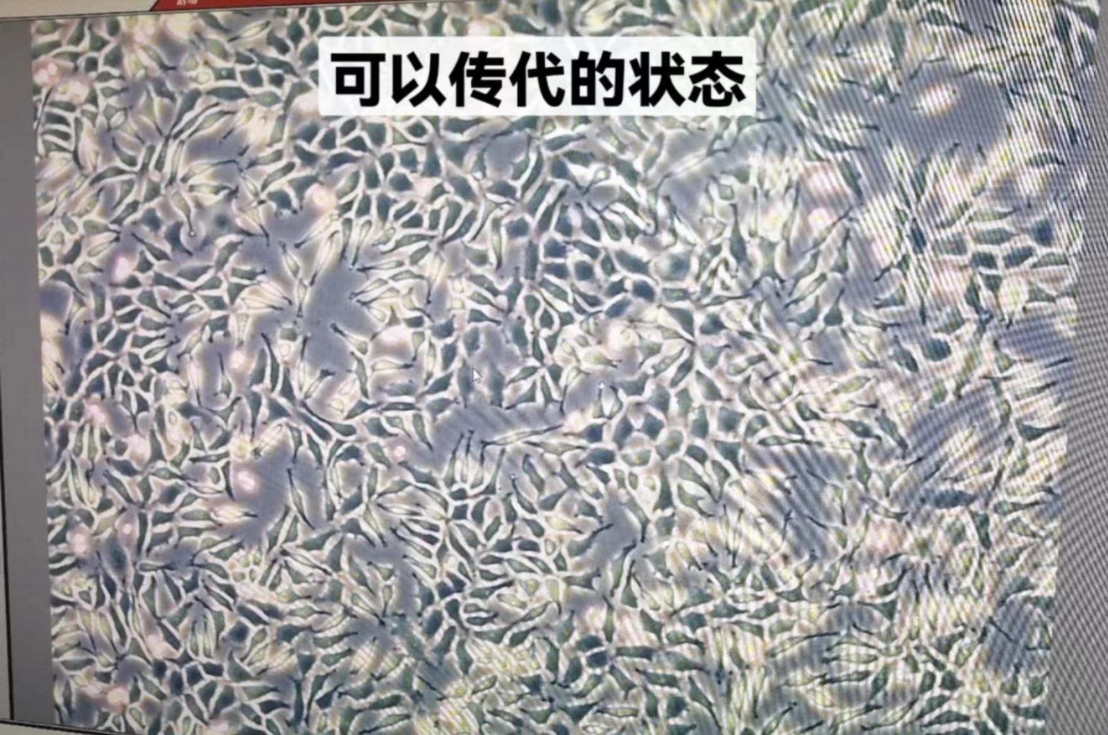 Hi科研 的想法: L929 细胞培养 传代 生物药理实验 | L929(小鼠成纤维细胞)细胞培养 取L929细胞株复苏，用10% 1640 ...