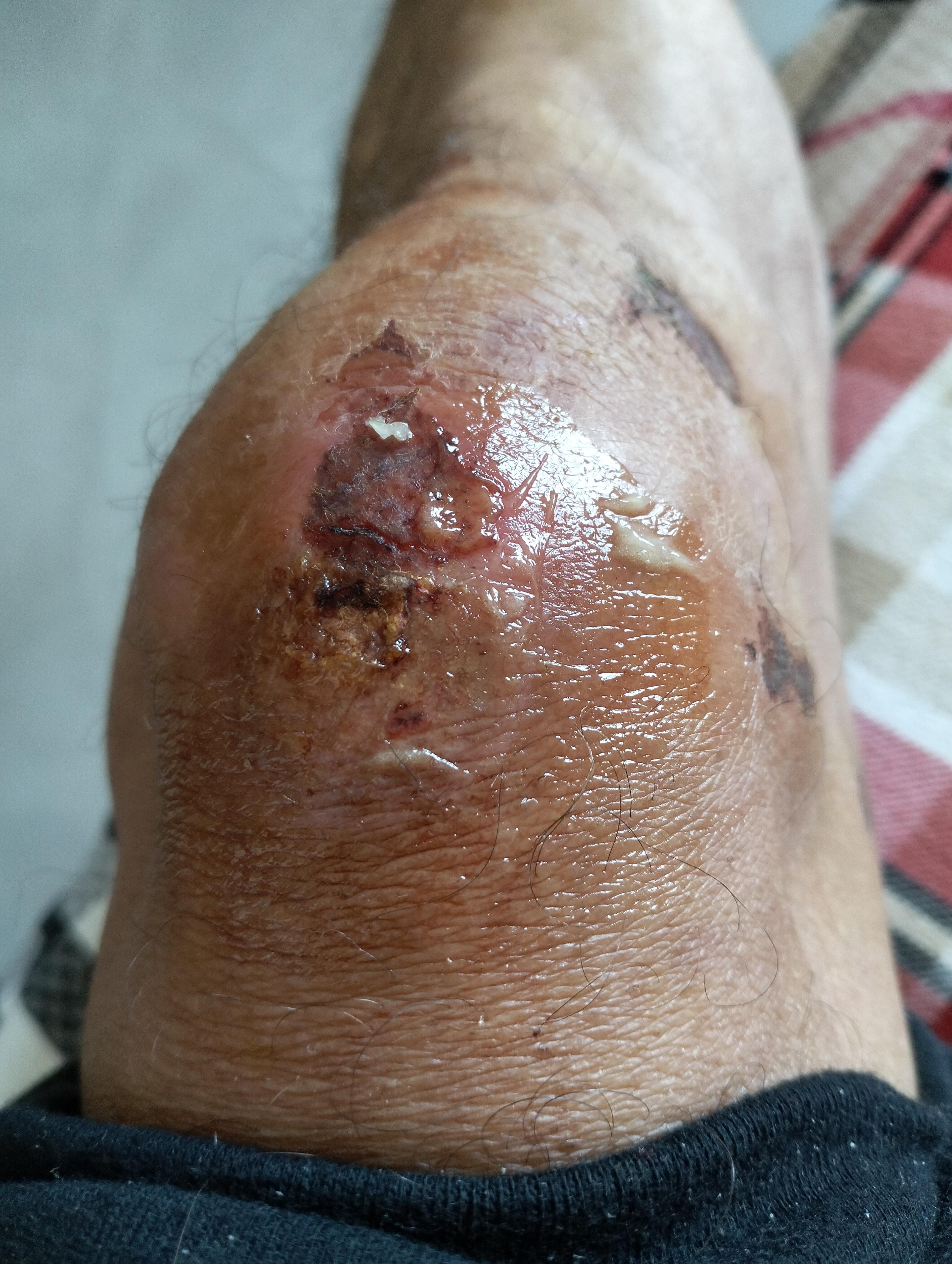 守望者 的想法: 运动记录日记十一月六日