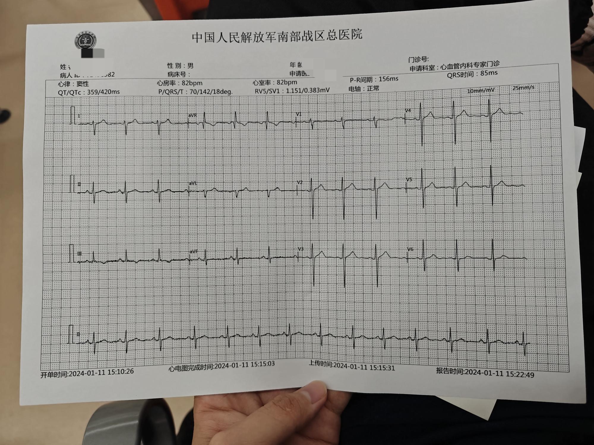 周小帅 的想法: 兵检心电图复检