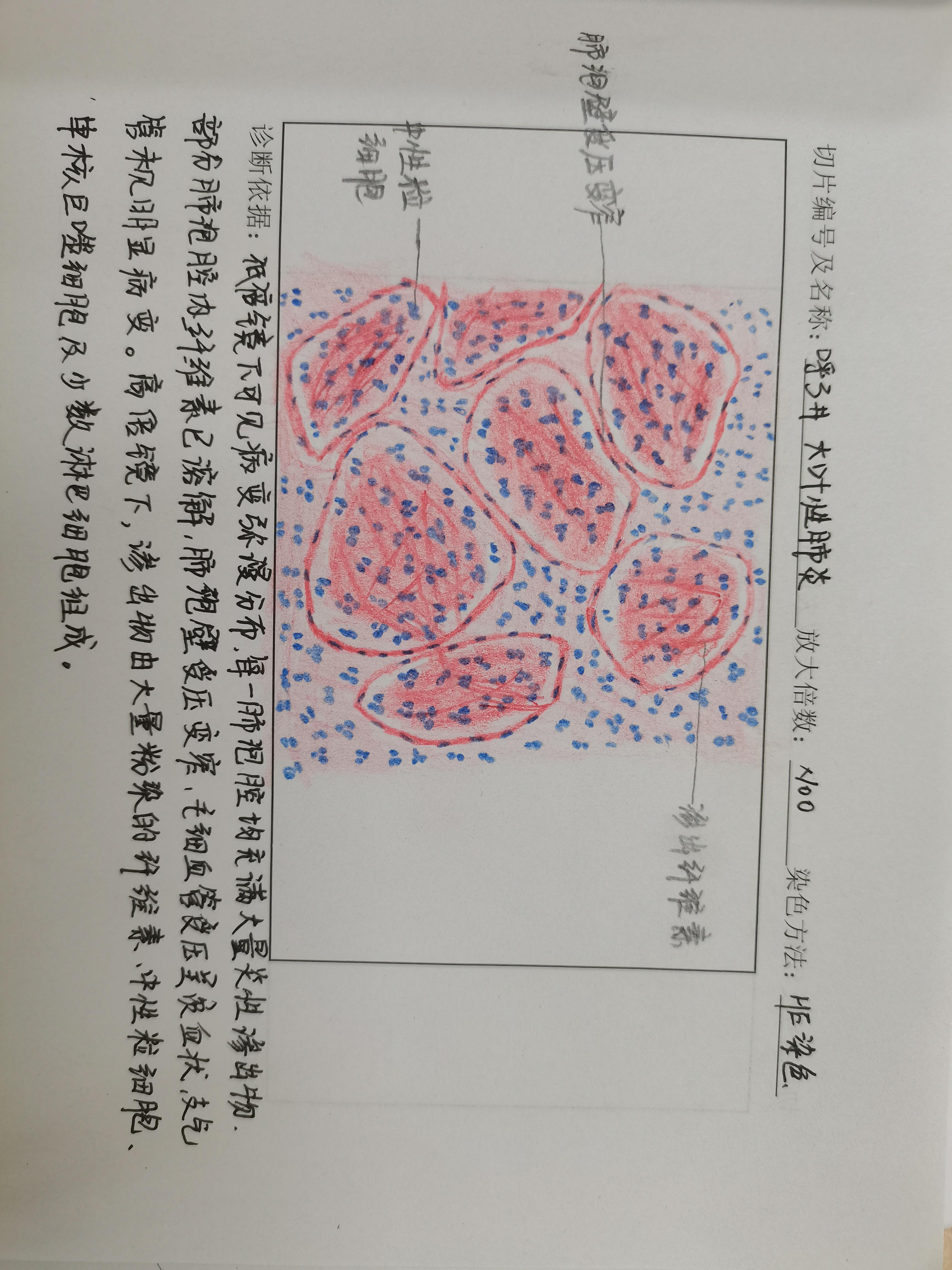 肺炎杆菌手绘图图片