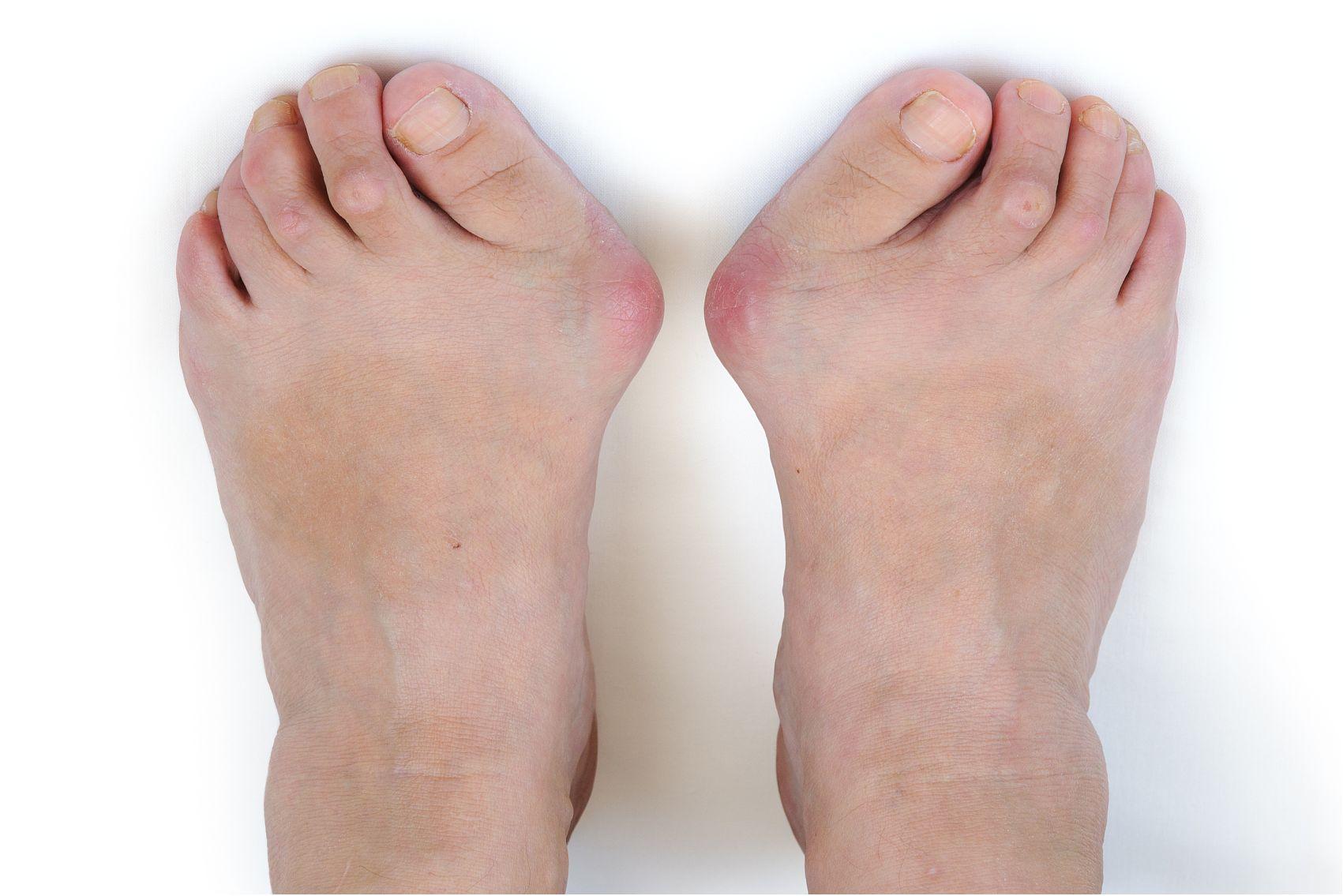 马桂文说大脚骨