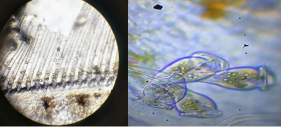 镜检纤毛虫图片