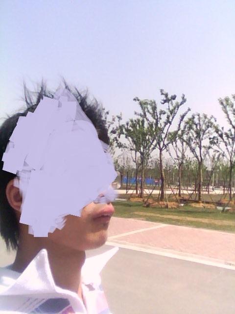 27岁开始戴牙套会不会太晚? - 牙套