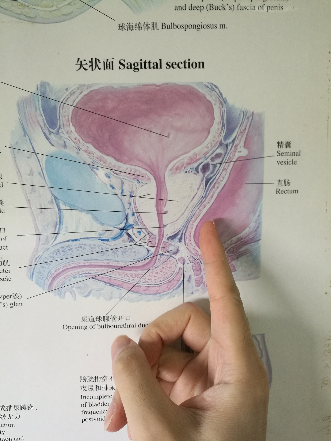 前列腺液怎么提取图片