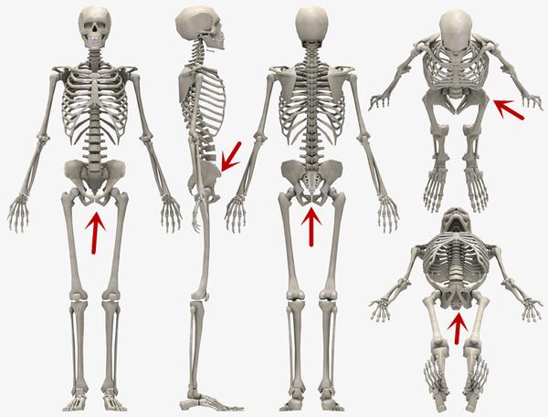 矫正含胸驼背之骨盆前倾