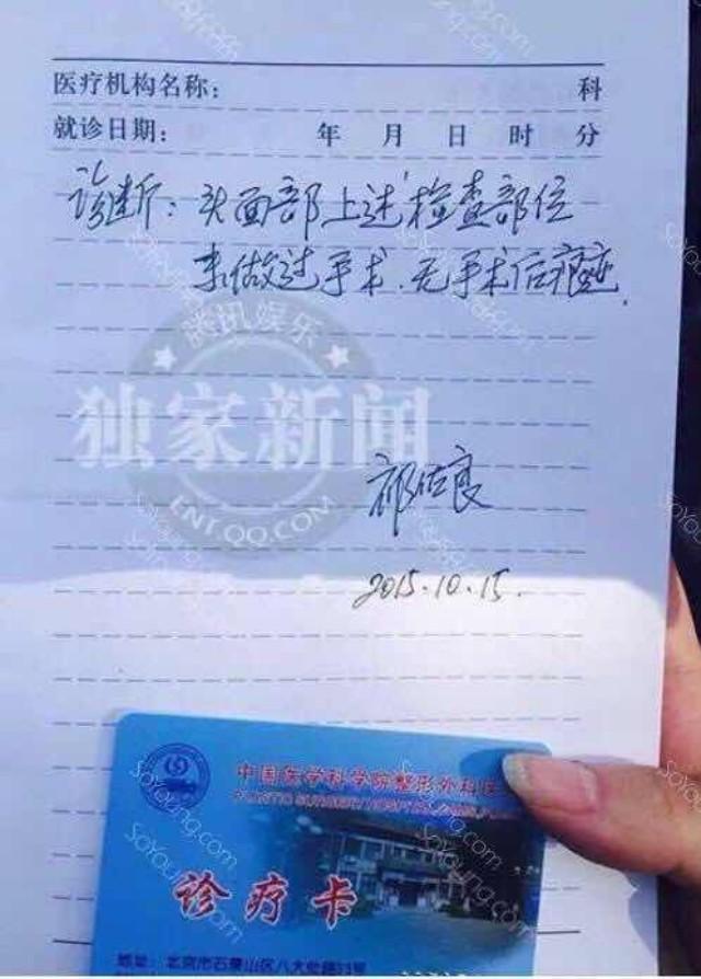 独家关于angelababy的整容鉴定你一定也有这些疑惑