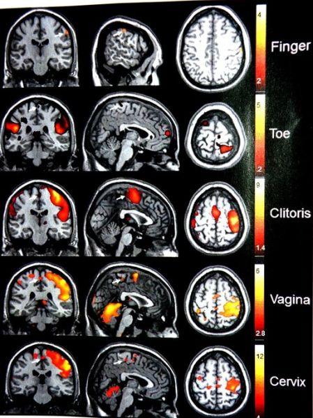 老美曾经使用核磁共振的方式记录了男女高潮时脑电波的活动,结果显示