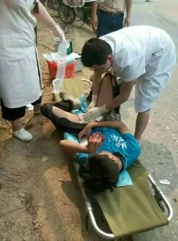 阴茎骨折怎么办?