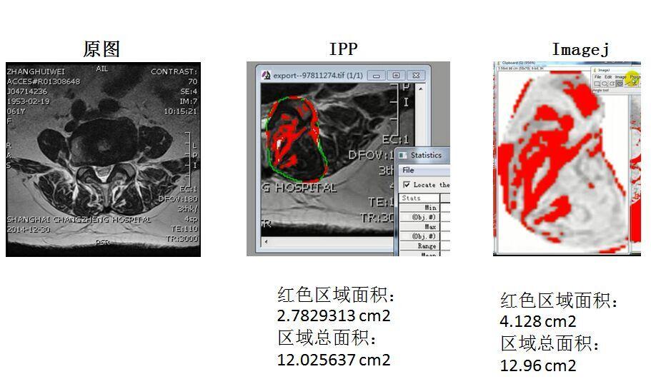 元2,imagej分析神經突起長度3,imagej中retfm-j插件分析分析he染色