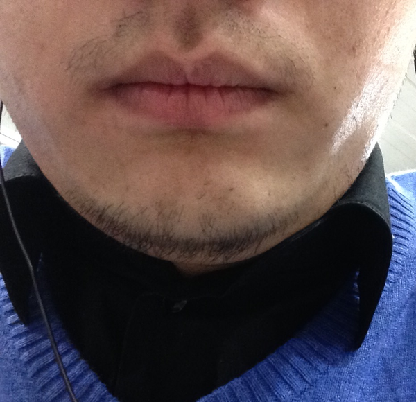 胡须:上唇长有胡须,唯独人中的地方没有胡须;下颌长有胡须;两颊长有几