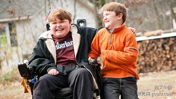假肥大性肌营养不良(duchennemuscular dystrophy, dmd)