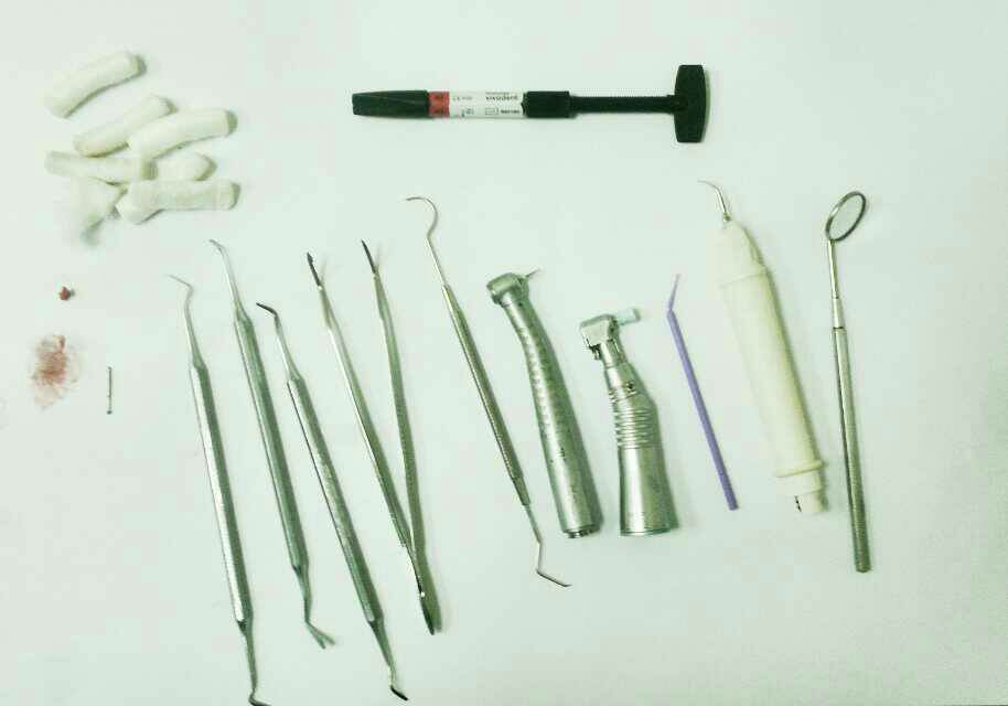 牙医是怎样补牙的,用到哪些工具?