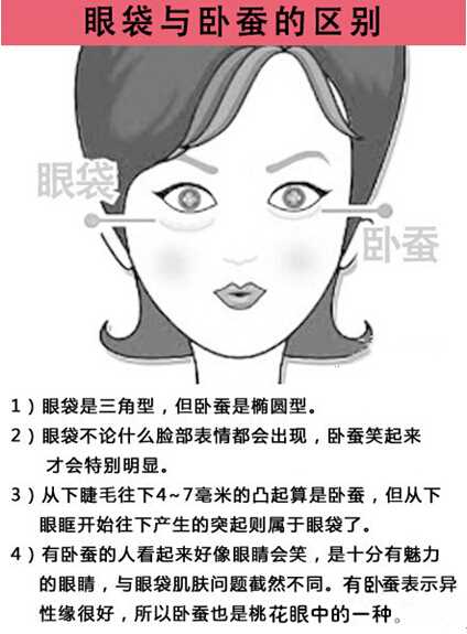 什么是 卧蚕 它跟眼袋有什么区别 知乎