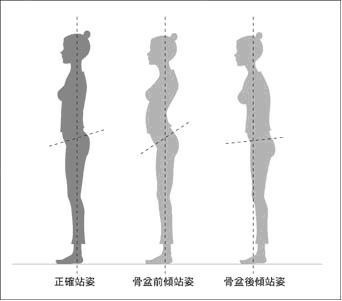 怎么区分骨盆前倾和后倾 知乎 怎么区分骨盆前倾和后倾 知乎