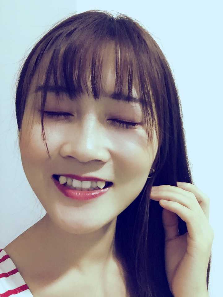 关键是有大虎牙