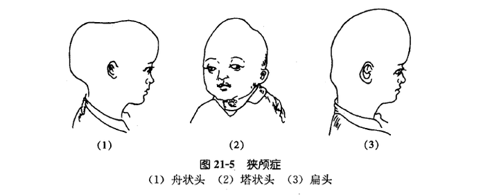 就会影响到脑子的发育,脑子长不起来,所以会影响智力,造成智力低下!