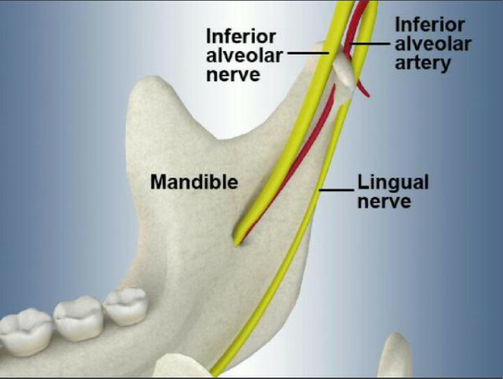 拔除智齿是有可能伤到它的,因为它离下颌管也就是下颌有神经的那个管