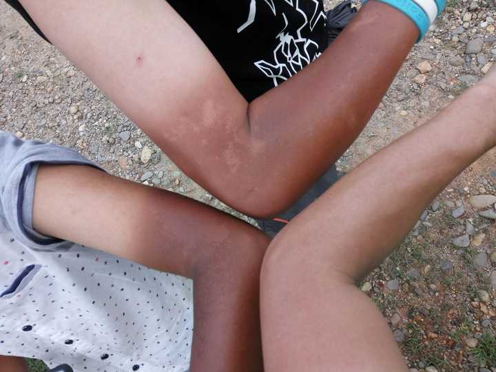 被晒得黑白分明是怎样的体验?