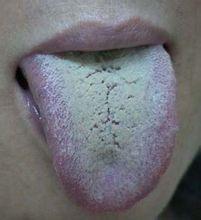 刷牙时怎么去掉舌根部的舌苔 知乎